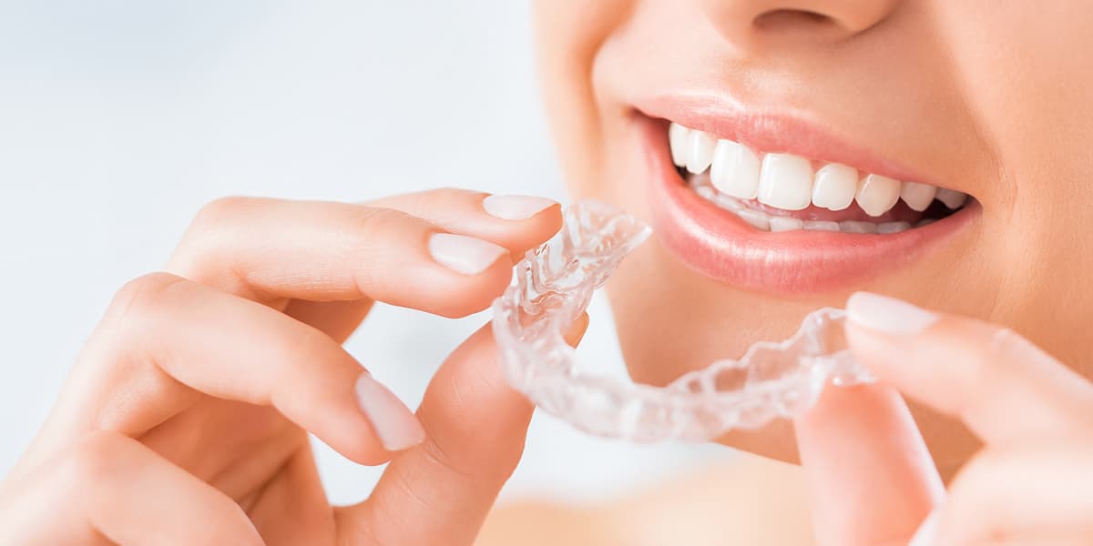 Invisible Braces: The Modern Way to Straighten Teeth