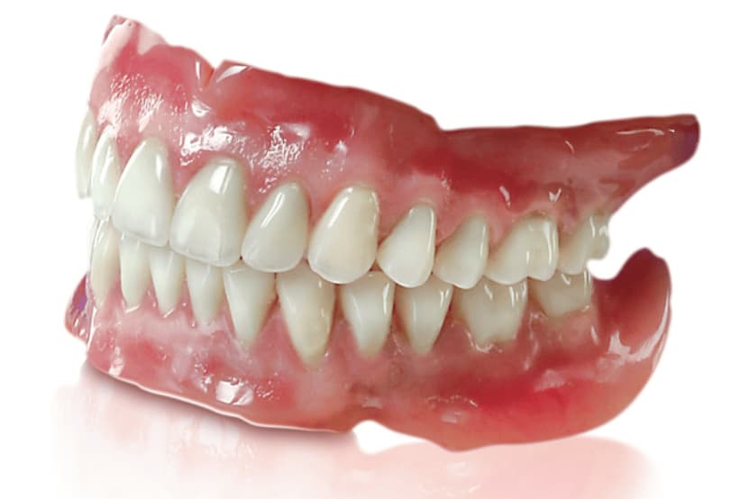 Dentures (Artificial Teeth)